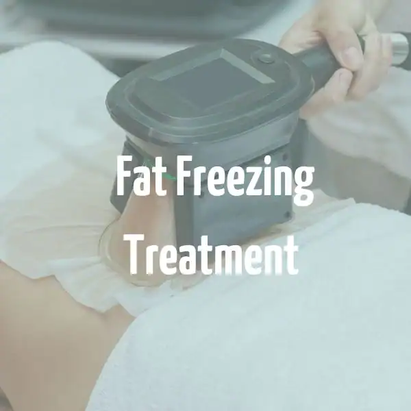 fat freezing treatment Tring
